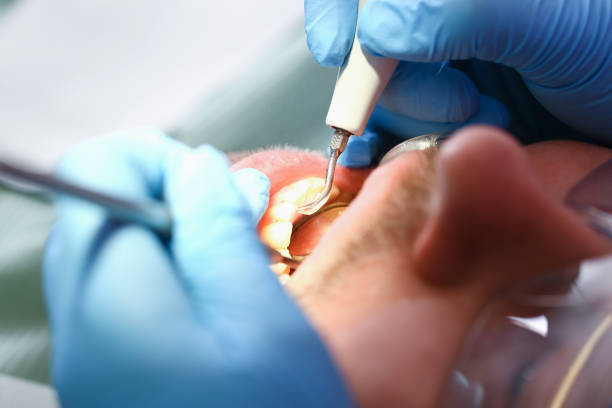 Best Emergency Dental Surgery in Aledo, IL